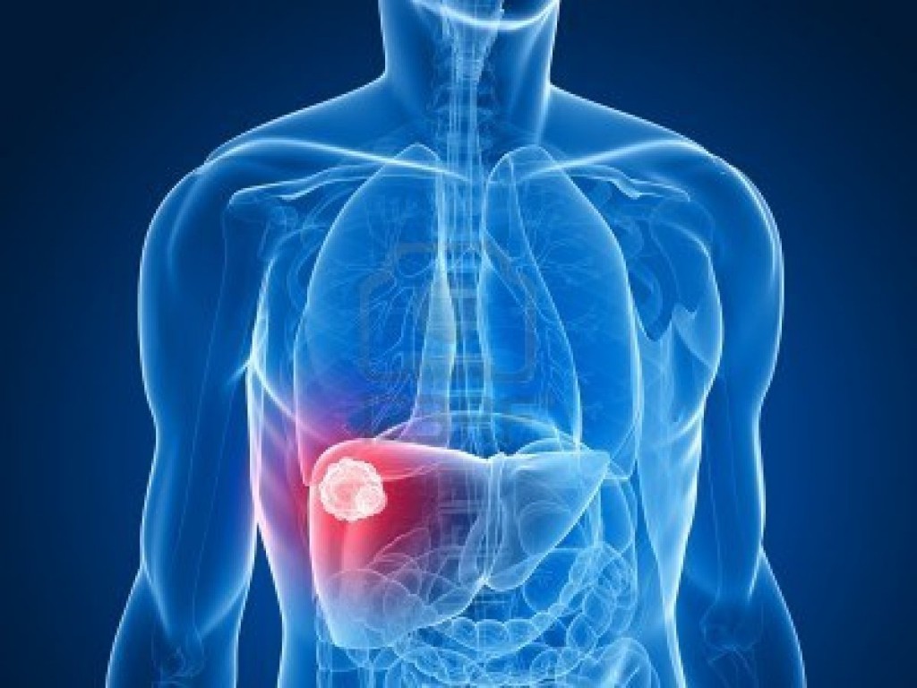 1377369803_6588804-transparent-body--liver-cancer